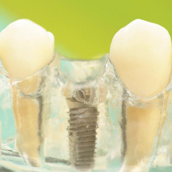 Behandlung von Erkrankungen des Zahnfleisches